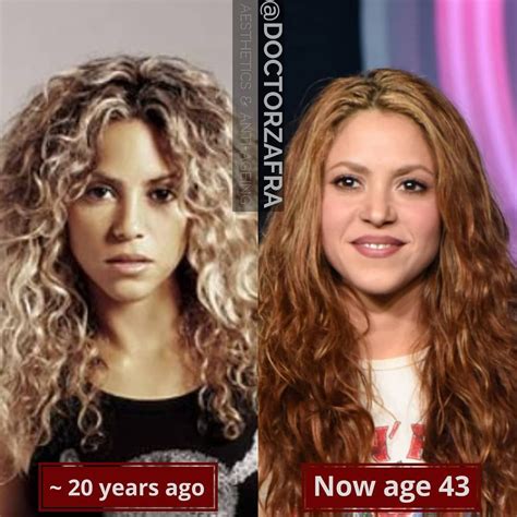 shakira aging